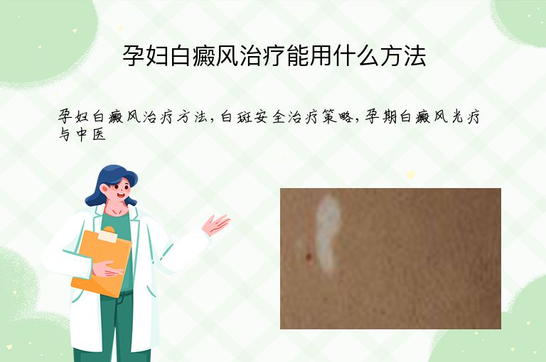 孕妇白癜风治疗能用什么方法”