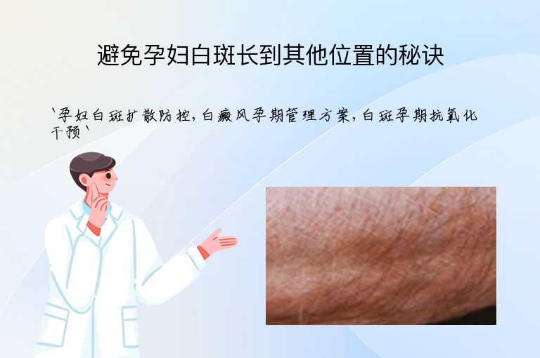 避免孕妇白斑长到其他位置的秘诀