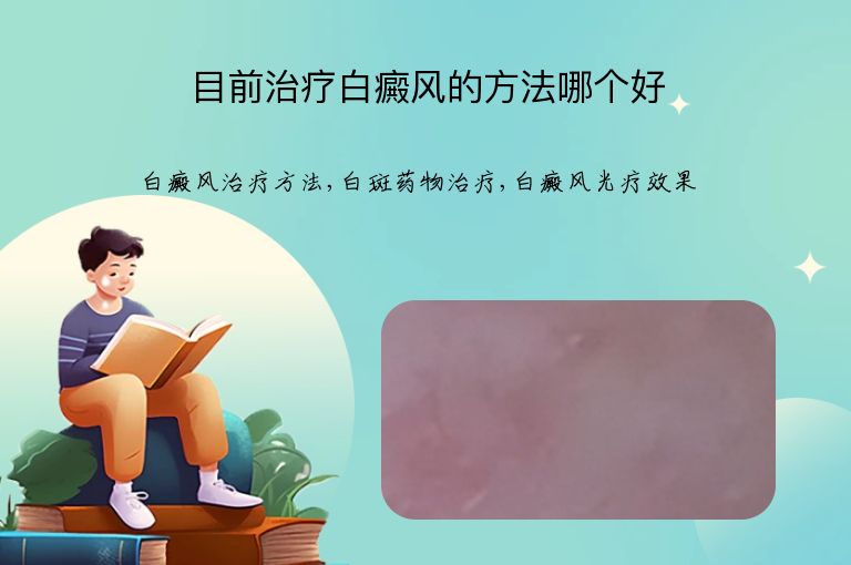 https://www.bdfsjzyy.com/d/file/p/47584119a0603675c2780cf0096b7ba7.jpeg