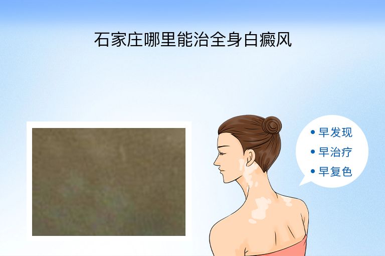 https://www.bdfsjzyy.com/d/file/p/9b5b61da8d6bd2453eb104f0381c5596.jpeg