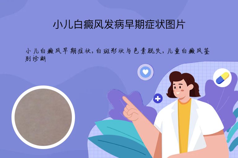 小儿白癜风发病早期症状图片”