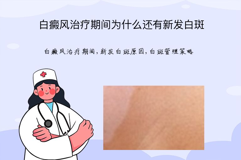 白癜风治疗期间为什么还有新发白斑”