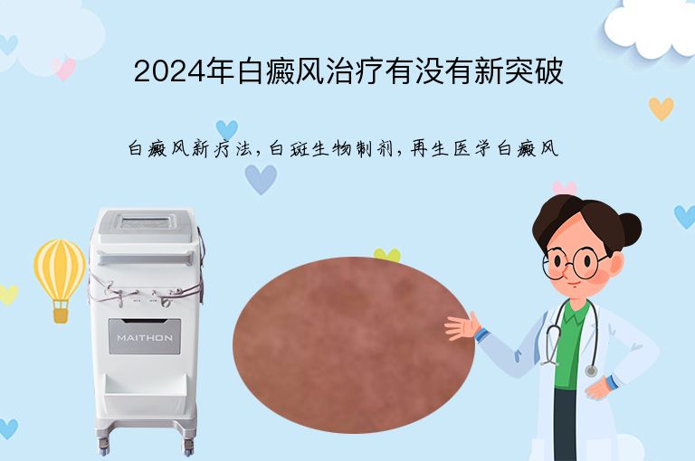 2024年白癜风治疗有没有新突破”