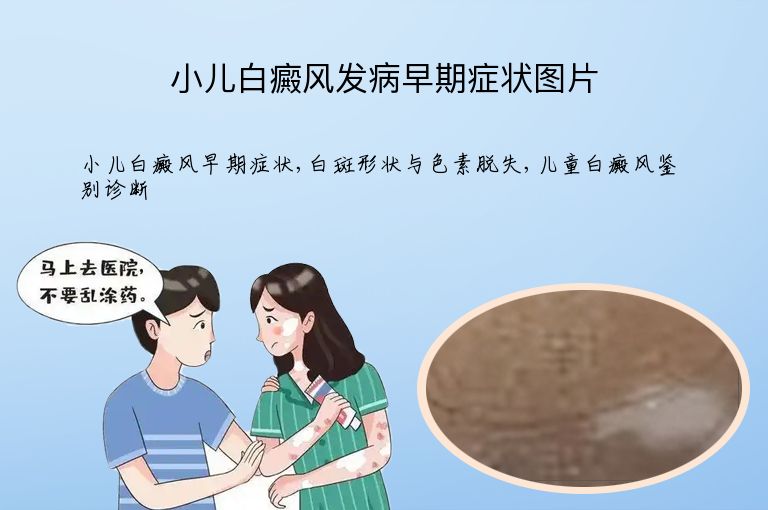 https://www.bdfsjzyy.com/d/file/p/725c7e0e9b9ffa49efa3875cd3470917.jpeg