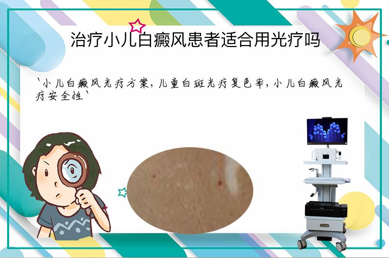 治疗小儿白癜风患者适合用光疗吗
