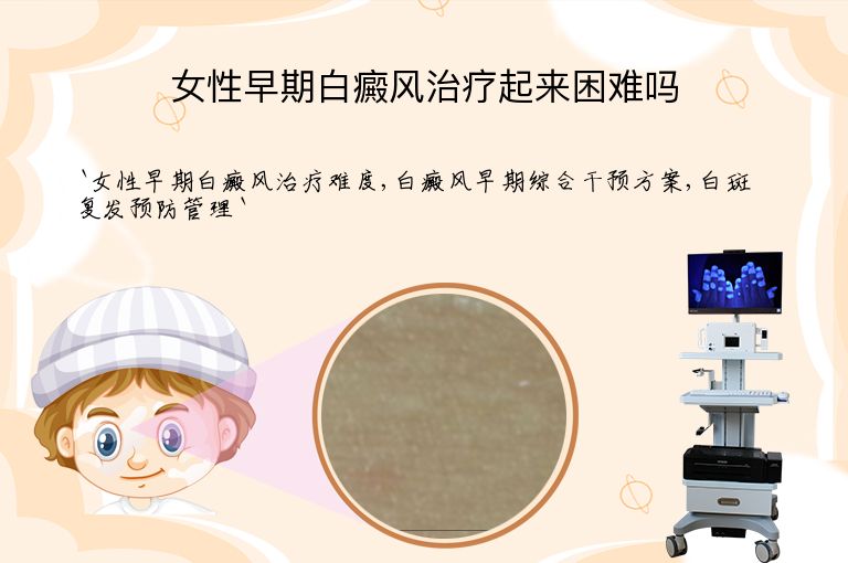 女性早期白癜风治疗起来困难吗”