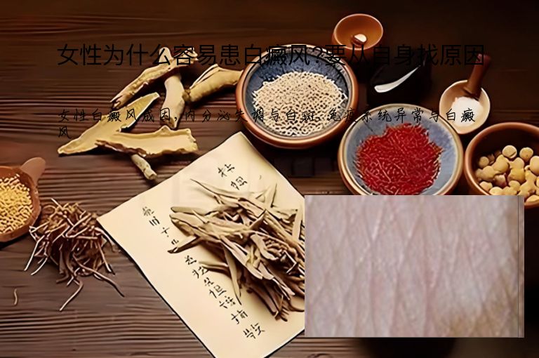 女性为什么容易患白癜风?要从自身找原因”