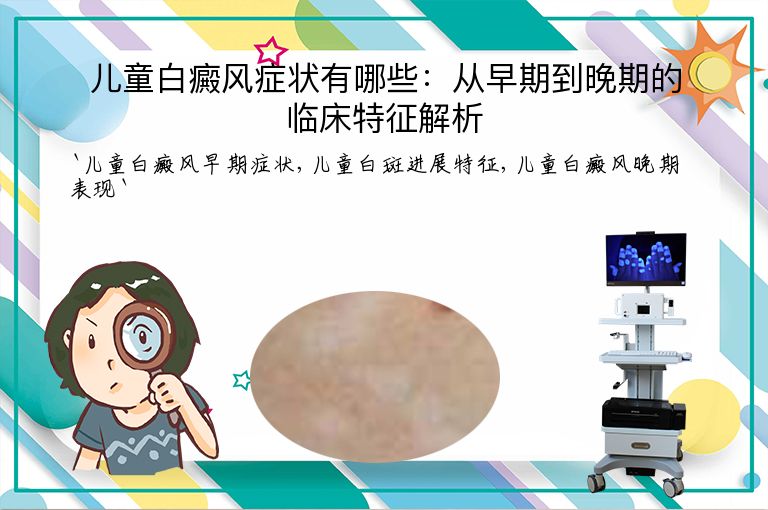 儿童白癜风症状有哪些:从早期到晚期的临床特征解析