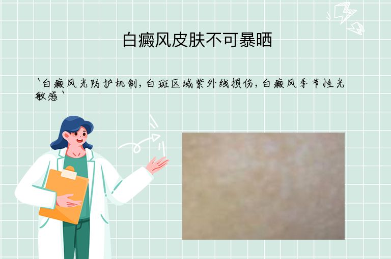 白癜风皮肤不可暴晒