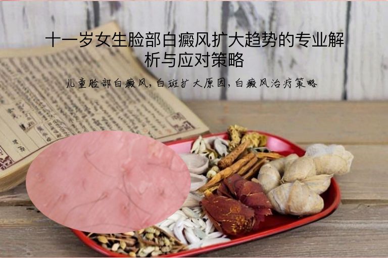 https://www.bdfsjzyy.com/d/file/p/69acc7fce331e19feb47ec31660b6ddf.jpeg