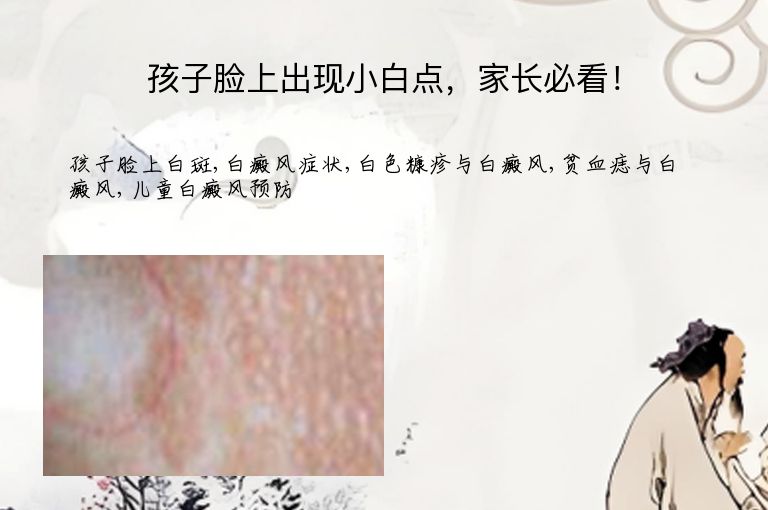 https://www.bdfsjzyy.com/d/file/p/93d6c1a54ca4b49e11c0f87926646451.jpeg