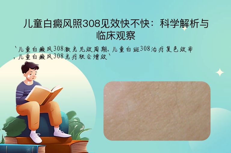 儿童白癜风照308见效快不快：科学解析与临床观察