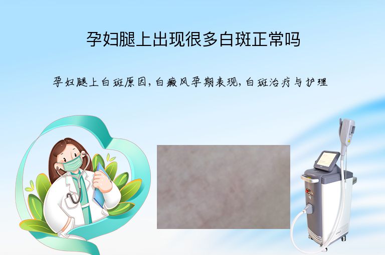 孕妇腿上出现很多白斑正常吗”