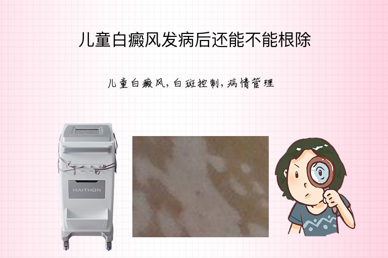 儿童白癜风发病后还能不能根除”