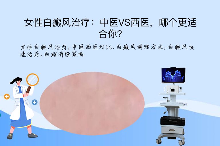 女性白癜风治疗:中医VS西医,哪个更适合你?”