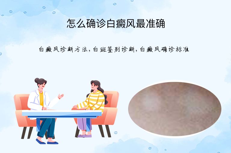 怎么确诊白癜风最准确”