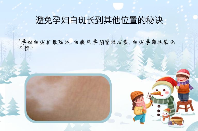 避免孕妇白斑长到其他位置的秘诀