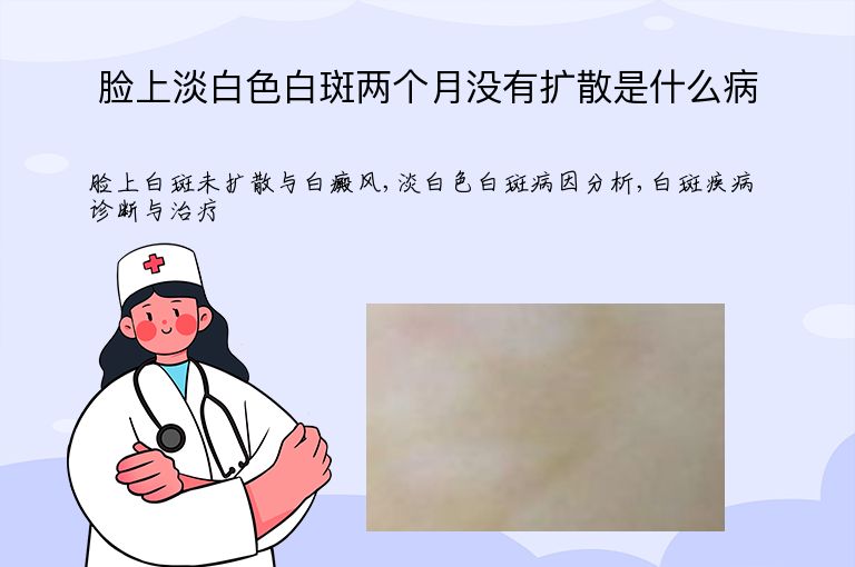 脸上淡白色白斑两个月没有扩散是什么病”