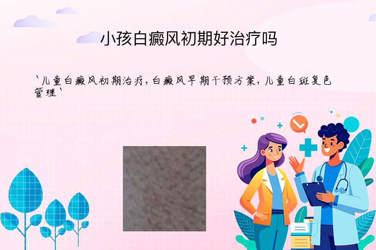小孩白癜风初期好治疗吗