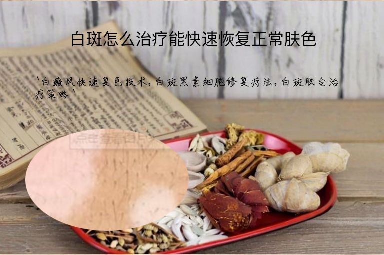 白斑怎么治疗能快速恢复正常肤色”