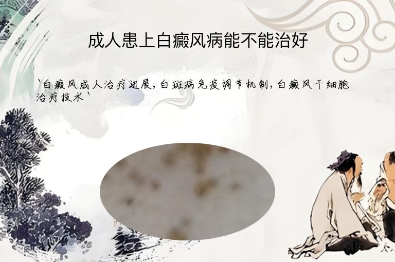 https://www.bdfsjzyy.com/d/file/p/19c54385698d4f1d53fbee84a5d96b4a.jpeg
