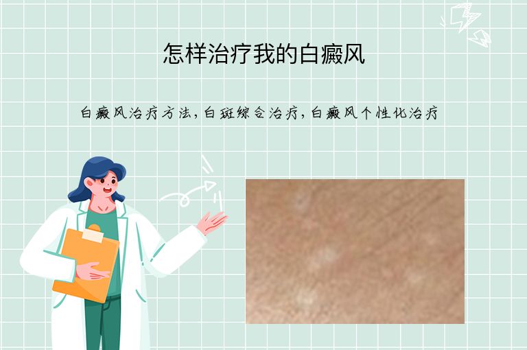 怎样治疗我的白癜风”
