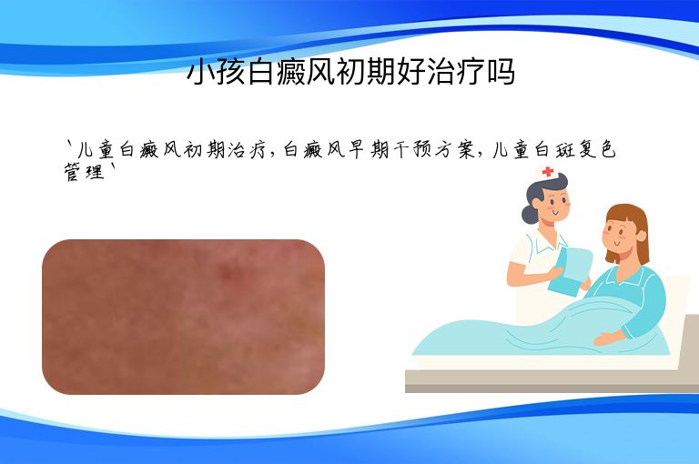 小孩白癜风初期好治疗吗