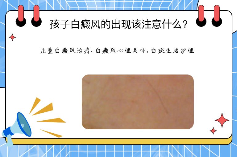 孩子白癜风的出现该注意什么?”
