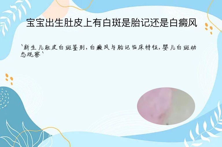 宝宝出生肚皮上有白斑是胎记还是白癜风”