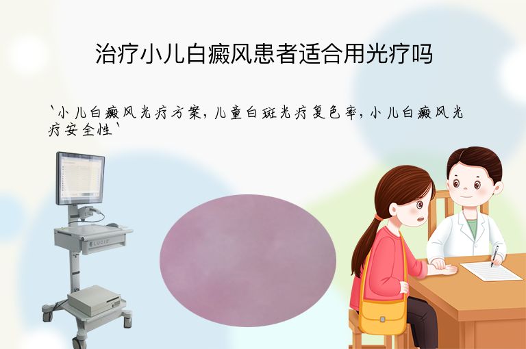 治疗小儿白癜风患者适合用光疗吗
