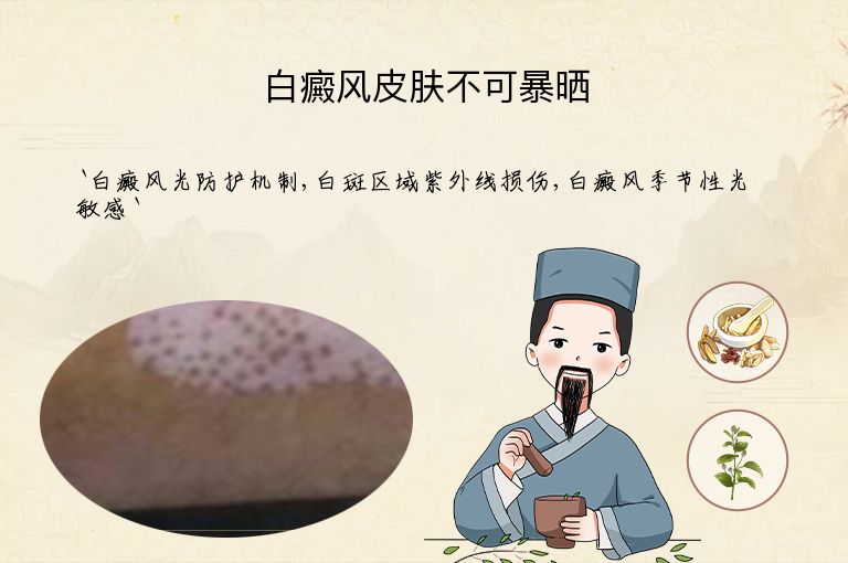 白癜风皮肤不可暴晒