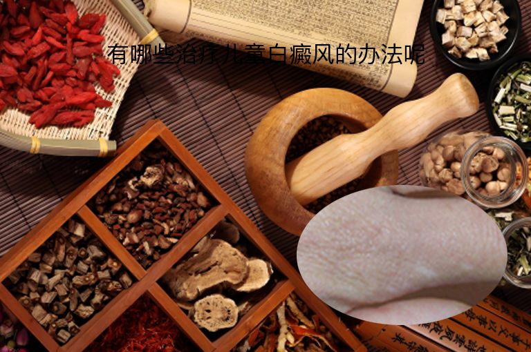 有哪些治疗儿童白癜风的办法呢”