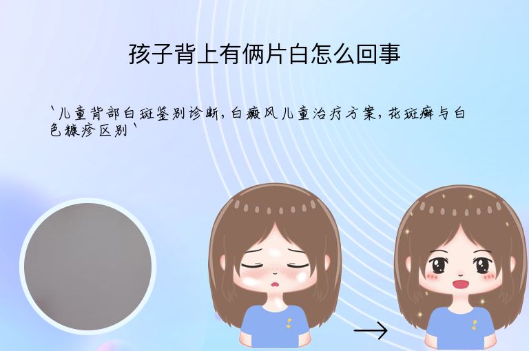 孩子背上有俩片白怎么回事