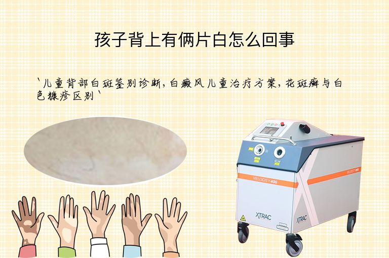 孩子背上有俩片白怎么回事
