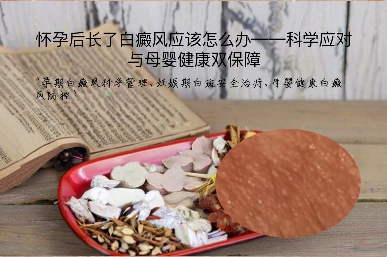 怀孕后长了白癜风应该怎么办——科学应对与母婴健康双保障”
