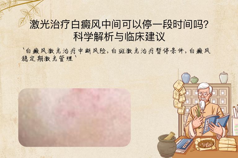 激光治疗白癜风中间可以停一段时间吗?科学解析与临床建议”