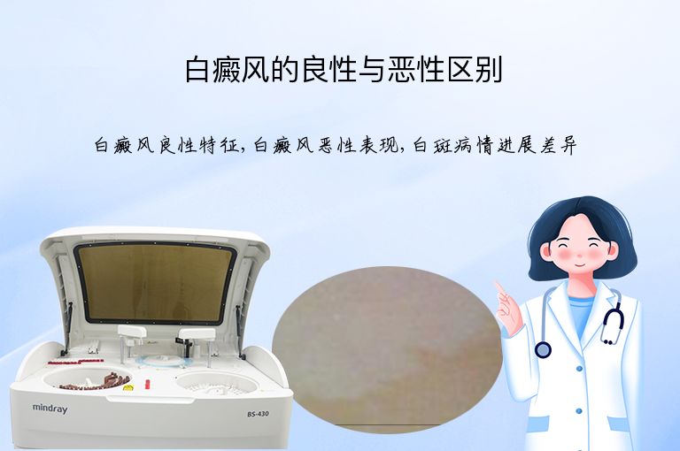 白癜风的良性与恶性区别”