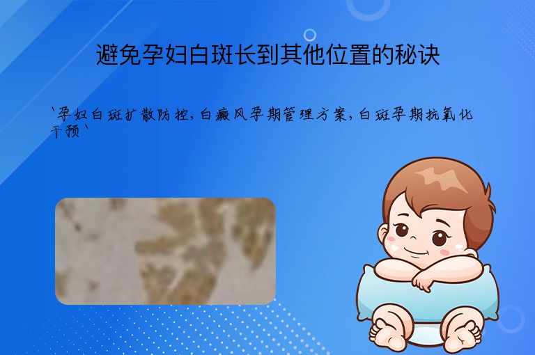 避免孕妇白斑长到其他位置的秘诀