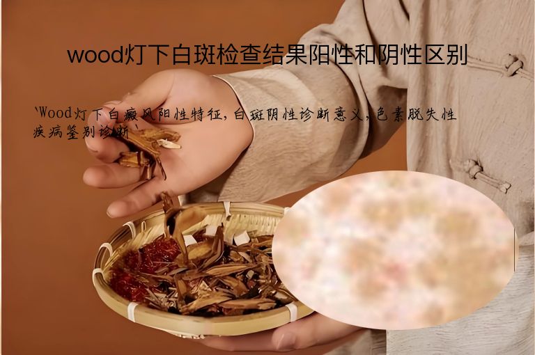 wood灯下白斑检查结果阳性和阴性区别”