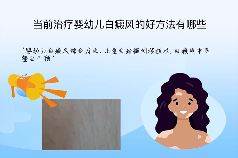 https://www.bdfsjzyy.com/d/file/p/07714895ffea0bdca6b97e52af8b48b0.jpeg