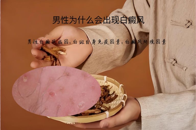 男性为什么会出现白癜风”