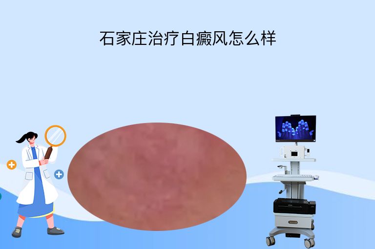 https://www.bdfsjzyy.com/d/file/p/d5c2d1be2532830f7a2dd841302b3b49.jpeg