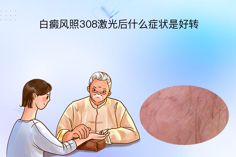 白癜风照308激光后什么症状是好转”