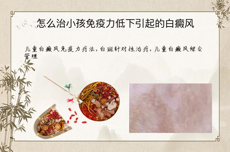 怎么治小孩免疫力低下引起的白癜风”