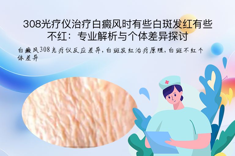 308光疗仪治疗白癜风时有些白斑发红有些不红:专业解析与个体差异探讨”