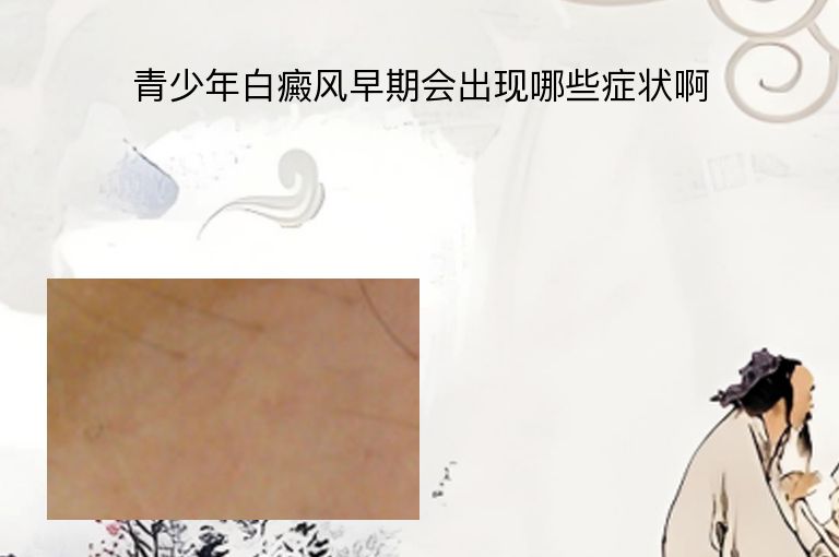 青少年白癜风早期会出现哪些症状啊
