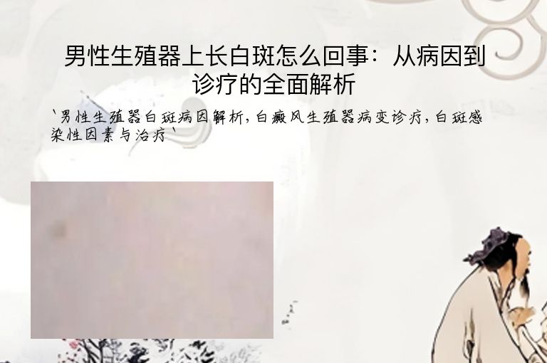 男性生殖器上长白斑怎么回事:从病因到诊疗的全面解析