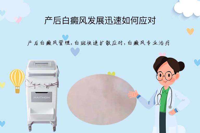 https://www.bdfsjzyy.com/d/file/p/631cd7b308f98c07643b6b3e08774af9.jpeg