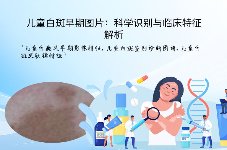 儿童白斑早期图片:科学识别与临床特征解析