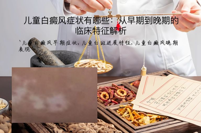 儿童白癜风症状有哪些:从早期到晚期的临床特征解析